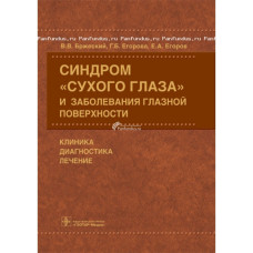 Синдром «сухого глаза» и заболевания глазной поверхности. Клиника, диагностика, лечение